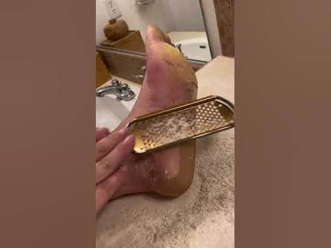 FOOT RASPING DAY! The other foot -- with EPPK Keratoderma