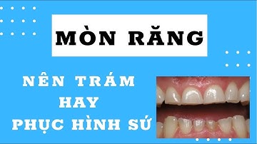 Mòn răng nên trám hay phục hình sứ | Tt niềng răng quốc tế Diamond