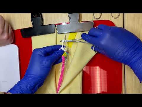 Ovarian Pedicle Tie