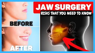 Corrective Jaw Surgery Recovery & Cost {Dentist REVIEW of Orthognathic Surgery} by Smile Influencers 50,913 views 2 years ago 9 minutes, 8 seconds