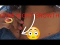 Grow Your Hair OVERNIGHT! Results In Less Than 12 Hours! | TESTED | Mel&#39;s World