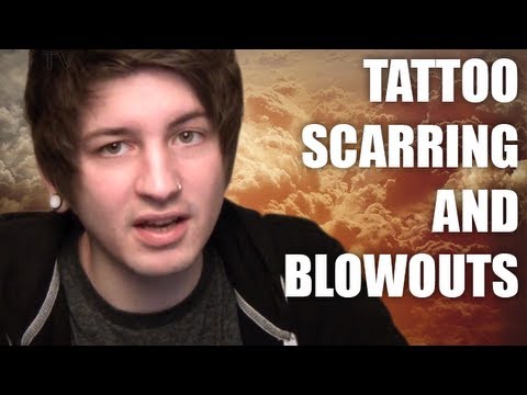 Video: Tattoo Scarring: Mohu Léčit Nebo Odstranit Nežádoucí Tattoo Scars?