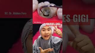 Luar Biasa, Proses Pembersihan Karang Gigi