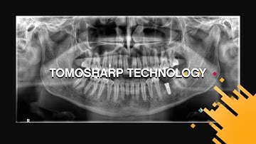 CS 8200 3D CBCT System With Tomosharp Technology