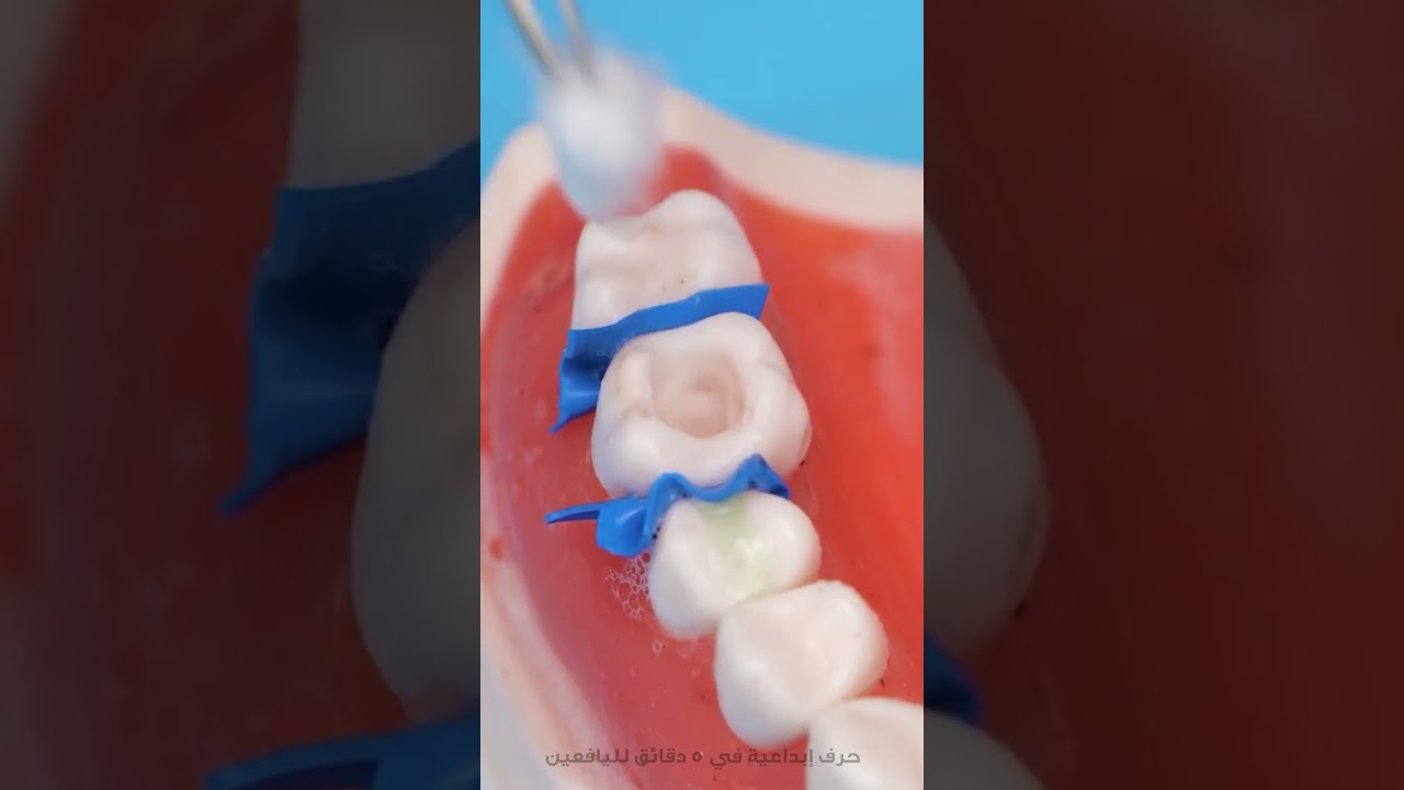 🦷 كيف تبدو جراحة الأسنان من خلال عيون طبيب 🦷