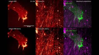 ZeroCostDL4Mic Video #7: Using Noise2Void 3D to denoise time-lapse fluorescence imaging