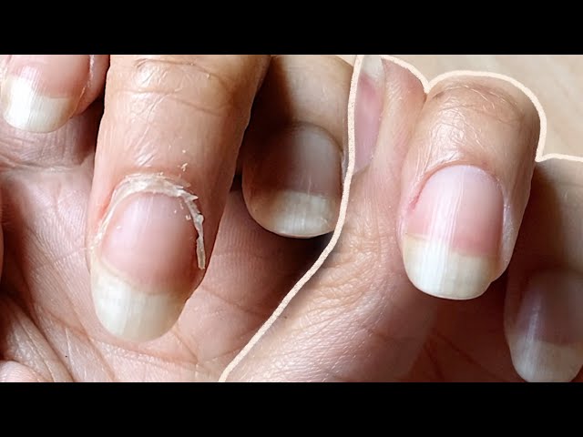 The Scary Reason You Should Never Get Your Cuticles Cut At The Nail Salon -  SHEfinds