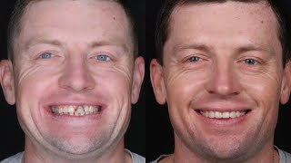 Transform your smile, transform your confidence! 