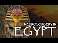 Ancient Egyptian Neurosurgery