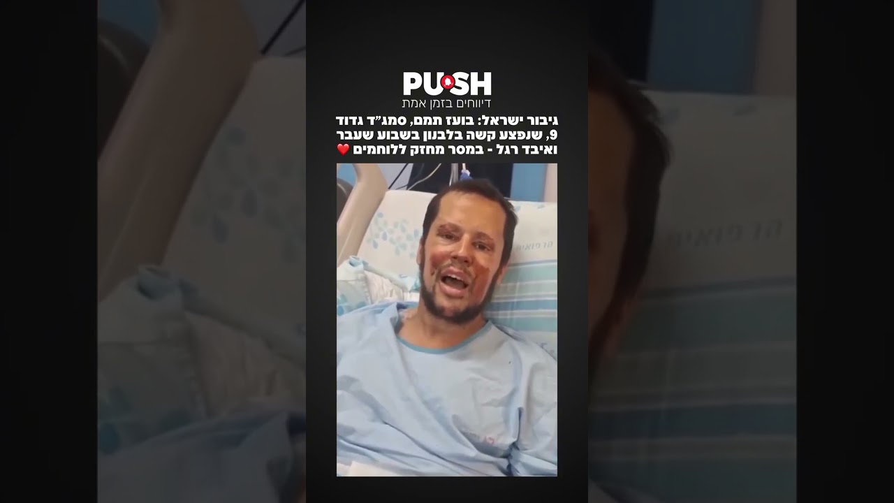 הלם!מהאצילות נפש! זאת בסך הכל רגל. אין מה לדאוג.
