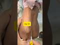 How to Insert a 24G Yellow IV Cannula on the Hand Perfectly! | Day 63 Clinical Skills#shorts #safi