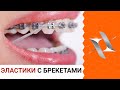 ЭЛАСТИКИ (тяги) и брекеты | Для чего? Как с ними жить?