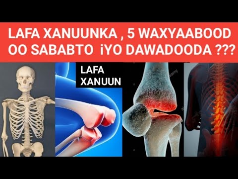 #LAFA-XANUUNKA#5 WAXYAABOOD OO SABABTO LAFA XANUUNKA IYO DAAWADOODA ??