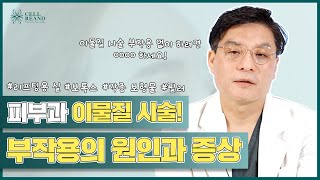 피부과 시술 고민중 이라면! 한 번은 꼭 확인해보세요, 이물질 시술의 모든 것!