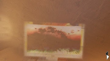 VISUAL SNOW with other symptoms-this is how it