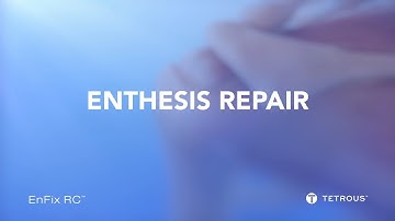 EnFix RC™ Rotator Cuff Procedure