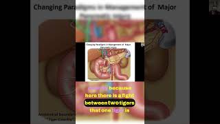 The Battle of the Pancreas A Surgical Perspective 🥋6