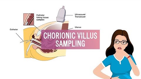 Dr. Chinmayee Ratha || Chronic Villus Sampling || NARIKAA