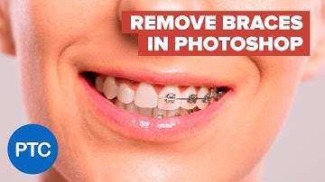 The BEST Way to Remove Braces With Photoshop