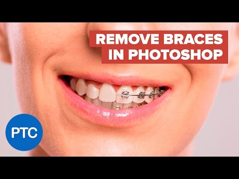 The BEST Way to Remove Braces With Photoshop