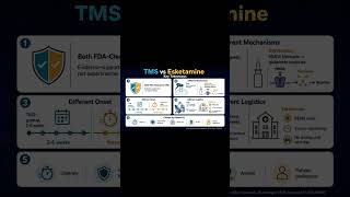 5 Key Takeaways: TMS vs Esketamine for Treatment-Resistant Depression