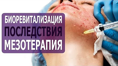 ПРОТИВОПОКАЗАНИЯ БИОРЕВИТАЛИЗАЦИИ И МЕЗОТЕРАПИИ. какие могут быть последствия