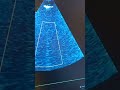 ultrasound artifact at different frequency #biomedicalengineering #biomedicalscience #ultrasoundtech
