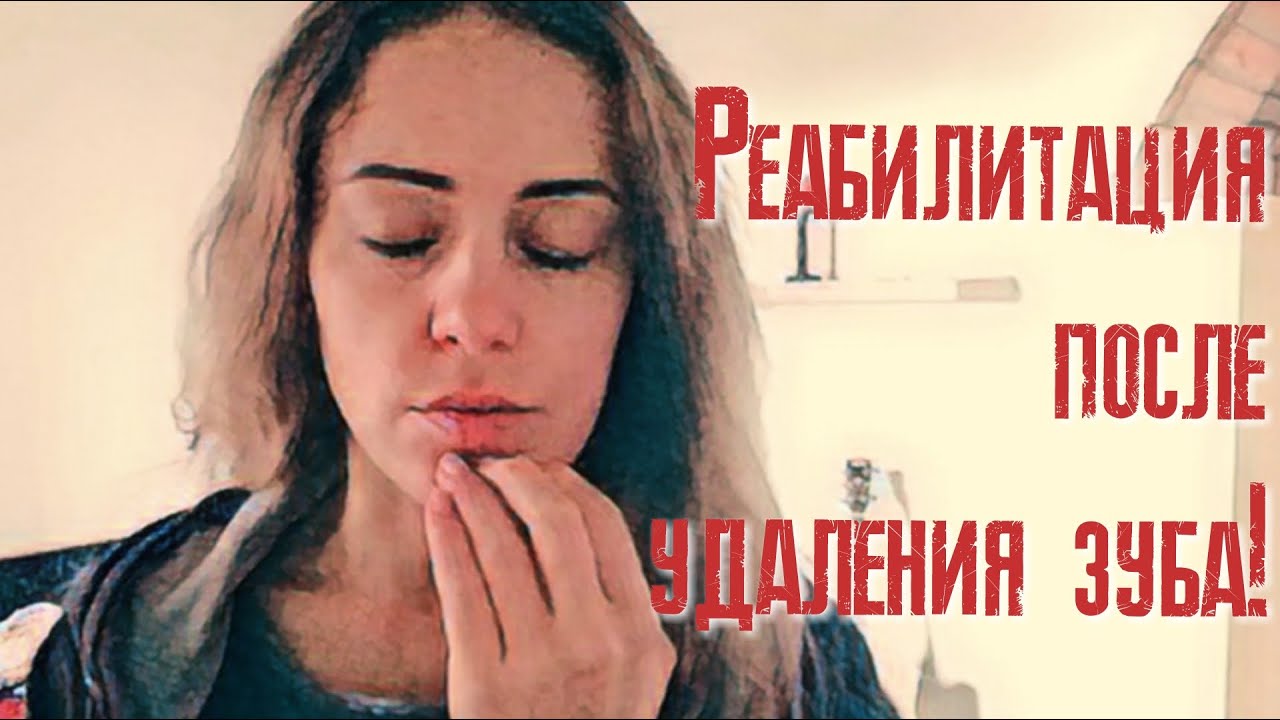 Реабилитация после удаления зуба мудрости