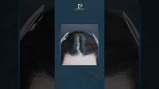 Bebas Beraktifitas Tanpa Masalah Rambut Adalah Salah Satu Hal Yang Membuat natalienovita Semakin Se