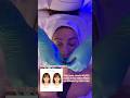 Buccal massage Bells Palsy & TMJ #buccal #facemassage #fascialrelease #massage #tmj #bellpalsy #skin