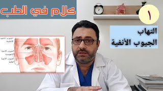 التهاب الجيوب الأنفية Sinusitis