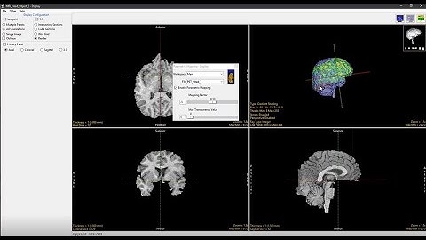 Analyze 14.0 - Display: Parametric Mapping