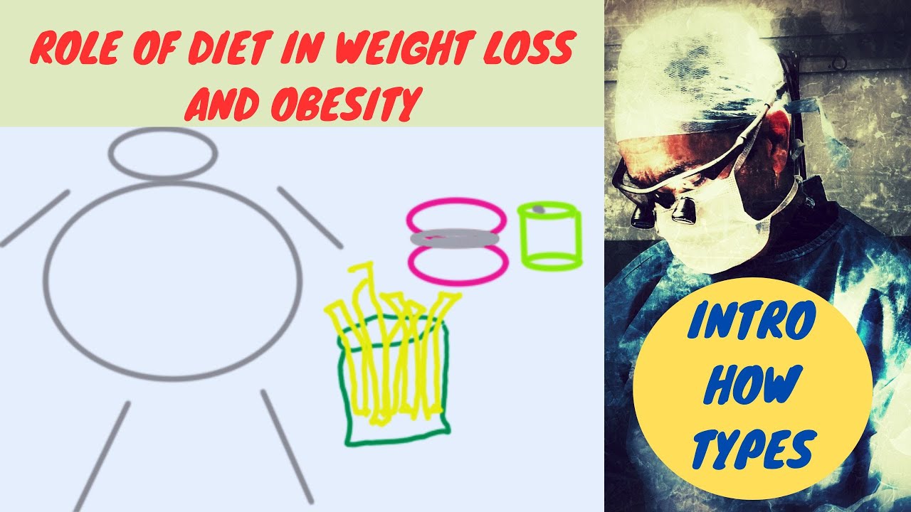 Role of Diet in Treating Obesity - YouTube