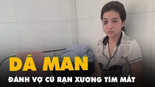 Bị chồng cũ đánh rạn xương hàm khi đến đón con