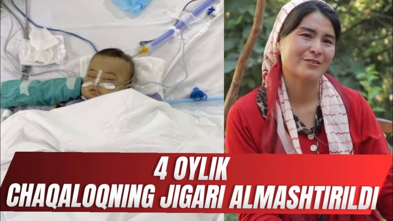 4 OYLIK CHAQALOQNING JIGAR ALMASHTIRISH OPERATSIYASI QANDAY O’TDI? 