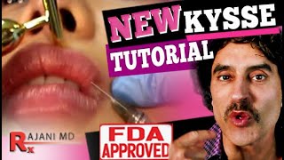 KYSSE RESTYLANE LIP FILLER TUTORIAL // Kysse New Lip Filler Before and After Picture