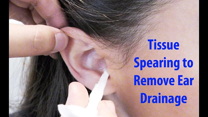 Tissue Spears to Remove Ear Drainage - DayDayNews