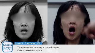 Пример лечения невралгии тройничного нерва видео Аюрведа при невралгии