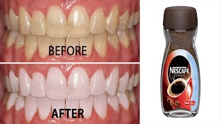 How to whiten teeth naturally with coffee in 2 minutes | Teeth whitening at home