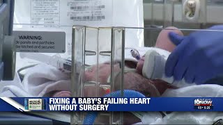 Medical Moment: Fixing a baby's failing heart without surgery