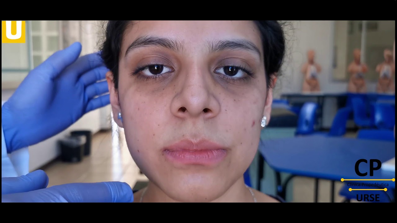 Exploración física de cabeza (nariz-boca-oido) 3/5  / CP URSE