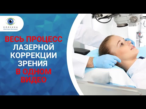 Как проходит лазерная коррекция зрения | Весь процесс — в одном видео