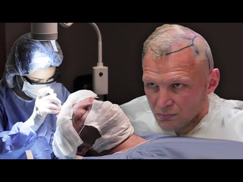 Video: Alexander Pryanikov had hair transplanted