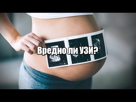 Вредно ли УЗИ при беременности, как часто можно делать УЗИ?