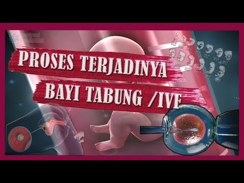 Proses Terjadinya Bayi Tabung | IVF