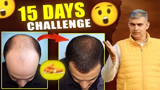11 Simple Foods To 5x Your Hair Growth in 15 Days (at zero cost)