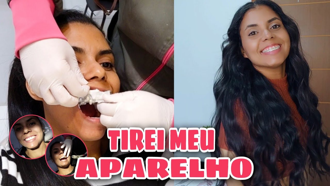 TIREI O APARELHO 10 ANOS DEPOIS / QUANTO CUSTOU MEU TRATAMENTO?