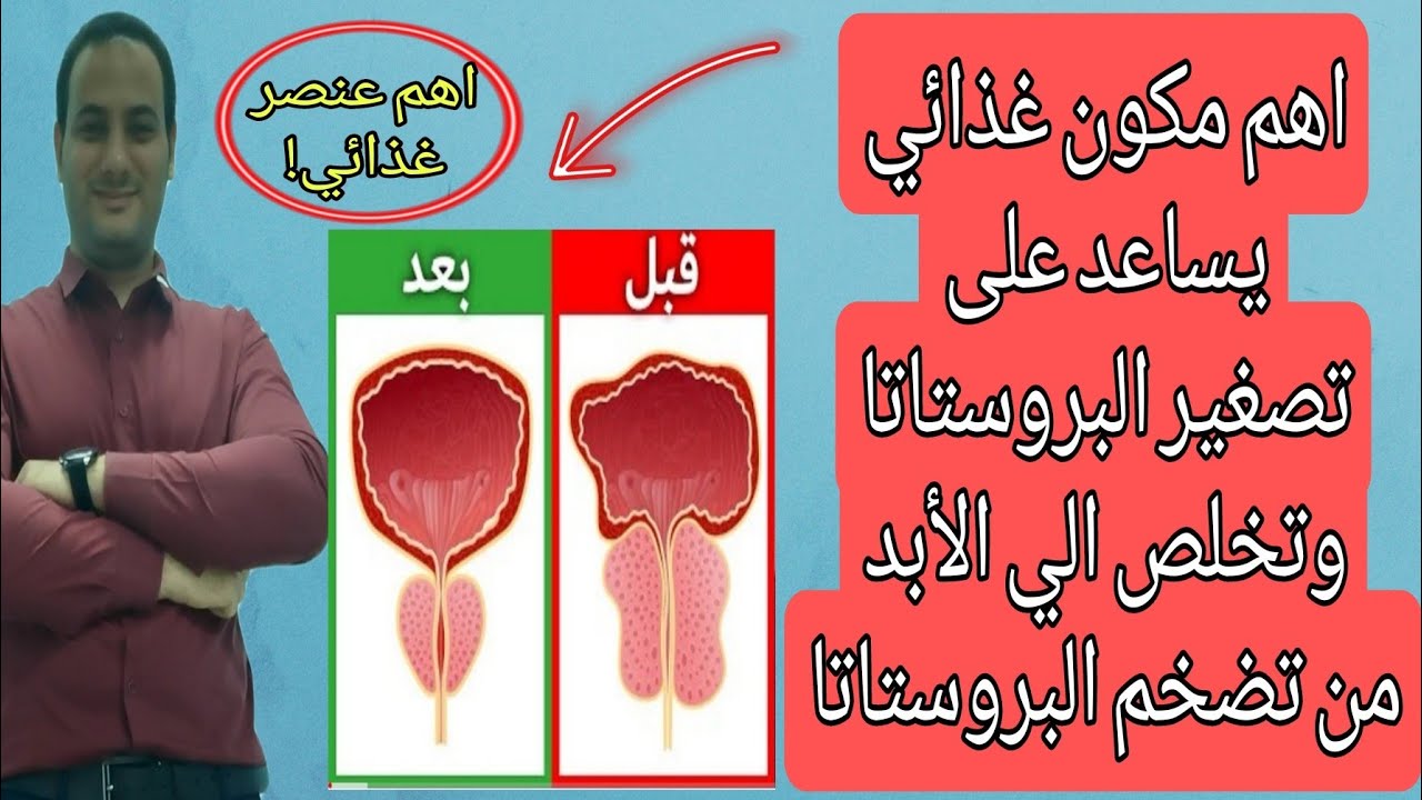 اهم مكون غذائي بلا منازع لتصغير البروستاتا | تخلص الي الأبد من تضخم البروستاتا وضعف الانتصاب✅