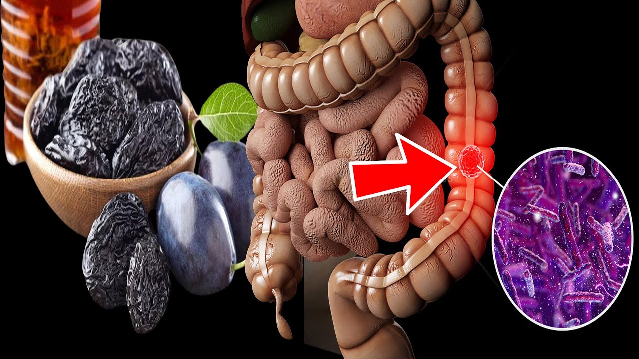 10 Incredible Fruits To Unclog Your Colon Fast - YouTube