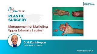 Management of Mutilating Upper Extremity Injuries